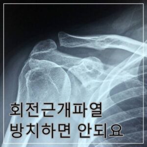 회전근개파열